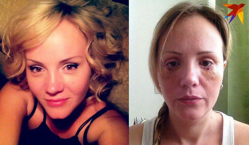 "Доктор Франкенштейн" из Украины изуродовала 16 россиянок: жуткие фото