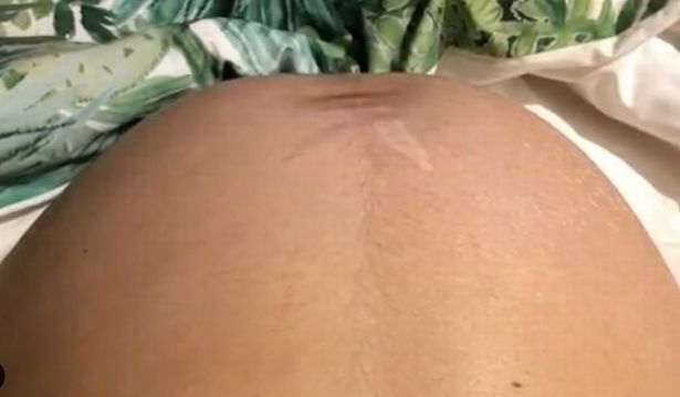 Зоряна вагітна матуся показала відео з танцями її малюка в животі