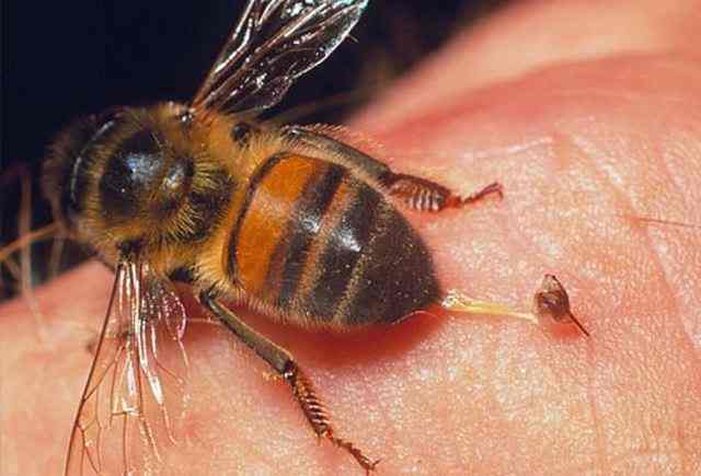 Бджолина отрута застосовується для лікування артриту