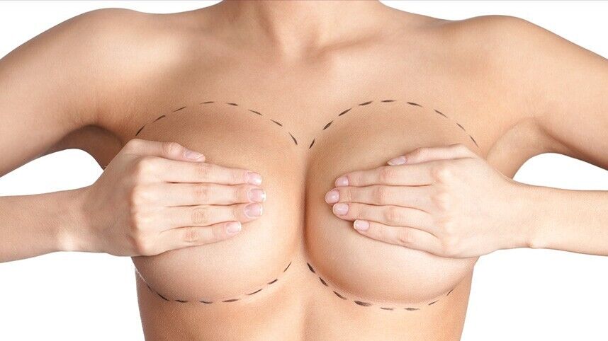 В операциях по изменению женской груди наметилась интересная тенденция