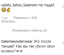 Бузова напугала поклонников синяками: что произошло