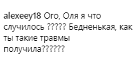 Бузова напугала поклонников синяками: что произошло