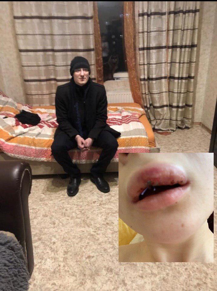 В России "полицейский" зверски избил проститутку: подробности жуткой истории