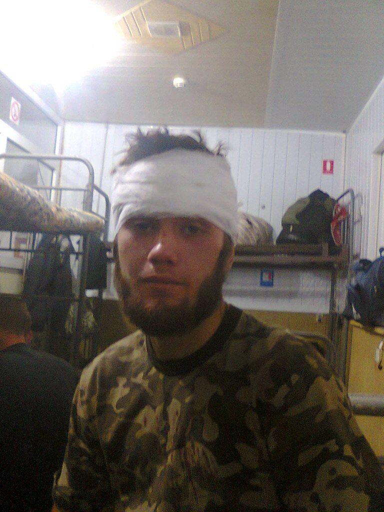 Відомого 24-річного терориста "Москву" ліквідовано на Донбасі