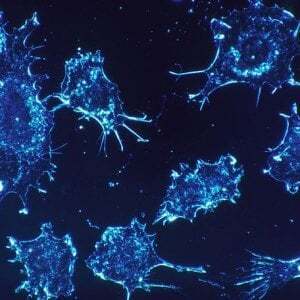 Як з'являється рак: вчені виявили причину смертельної хвороби