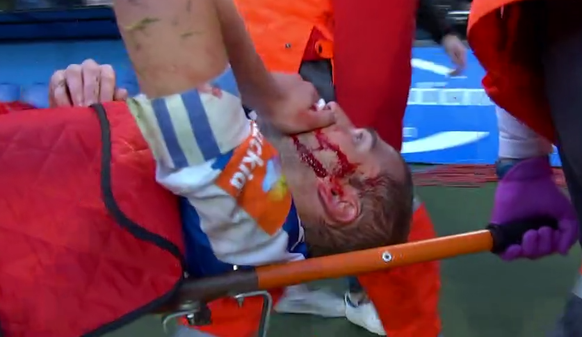 Футболист въехал прямой ногой в лицо сопернику: страшное видео