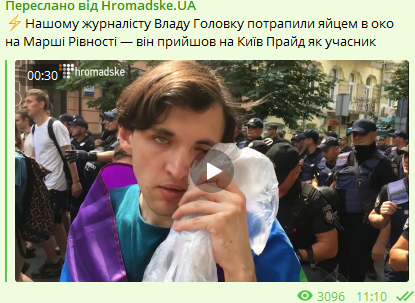 Марш рівності у Києві: журналіст ледь не позбувся ока через яйце