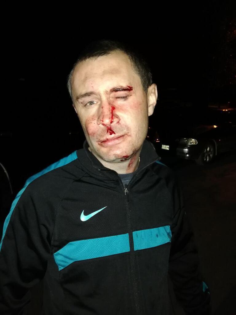 Кандидата по округу №220 в Киеве Дидовца обвинили в избиении волонтера