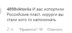 "Що з обличчям?" Лорак запідозрили у невдалій пластиці