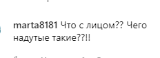 "Що з обличчям?" Лорак запідозрили у невдалій пластиці