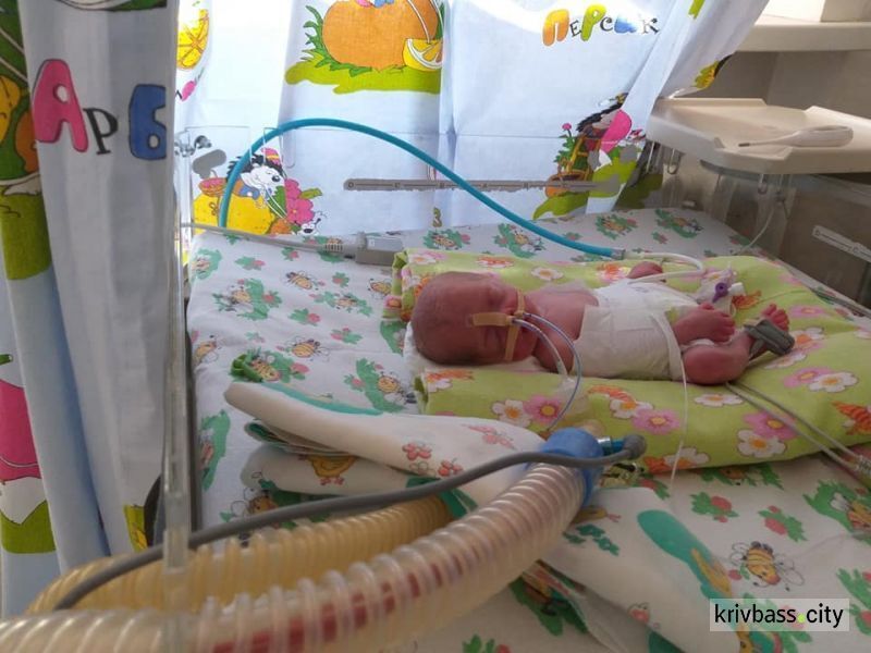 У Дніпрі рятують крихітних новонароджених двійнят: фото