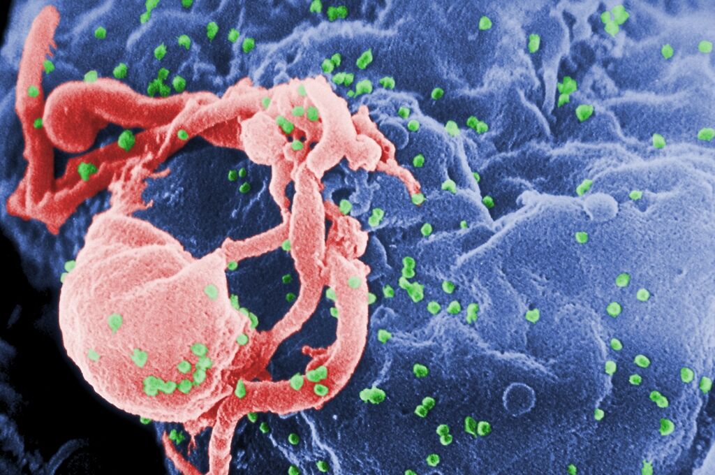 Препарат для профілактики ВІЛ проходить клінічні випробування