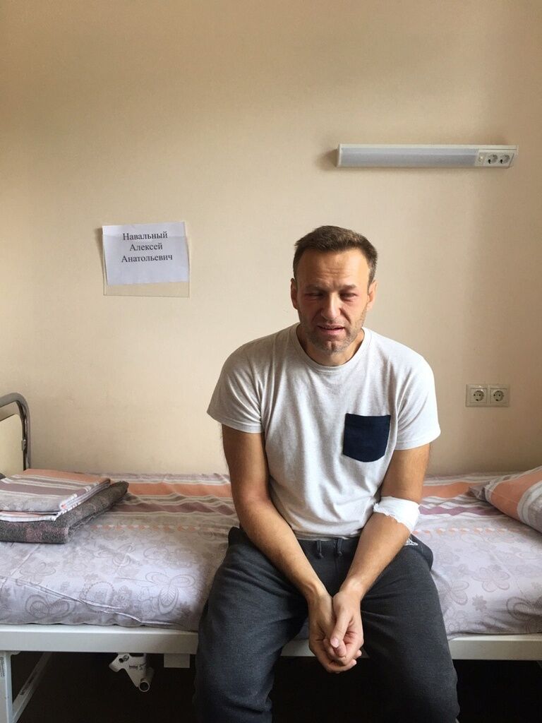 Навальний в лікарні