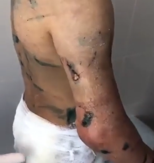 Чуть не отрезали руку: в России родная тетя зверски пытала 7-летнюю девочку. Видео 18+