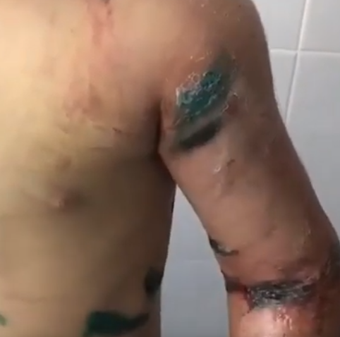 Чуть не отрезали руку: в России родная тетя зверски пытала 7-летнюю девочку. Видео 18+