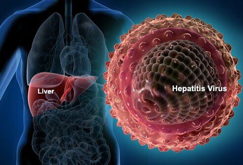 Гепатит: причини, симптоми, шляхи передачі, лікування