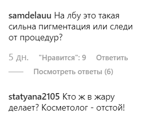 "Вас побили?" Запрещенная в Украине ведущая озадачила сеть странными пятнами на лице