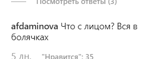 "Вас побили?" Заборонена в Україні ведуча спантеличила мережу дивними плямами на обличчі