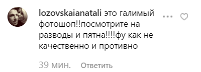 "Що за рубець під пупком?" Каменських стривожила мережу знімком у купальнику