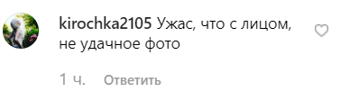 "Что за рубец под пупком?" Каменских встревожила сеть снимком в купальнике