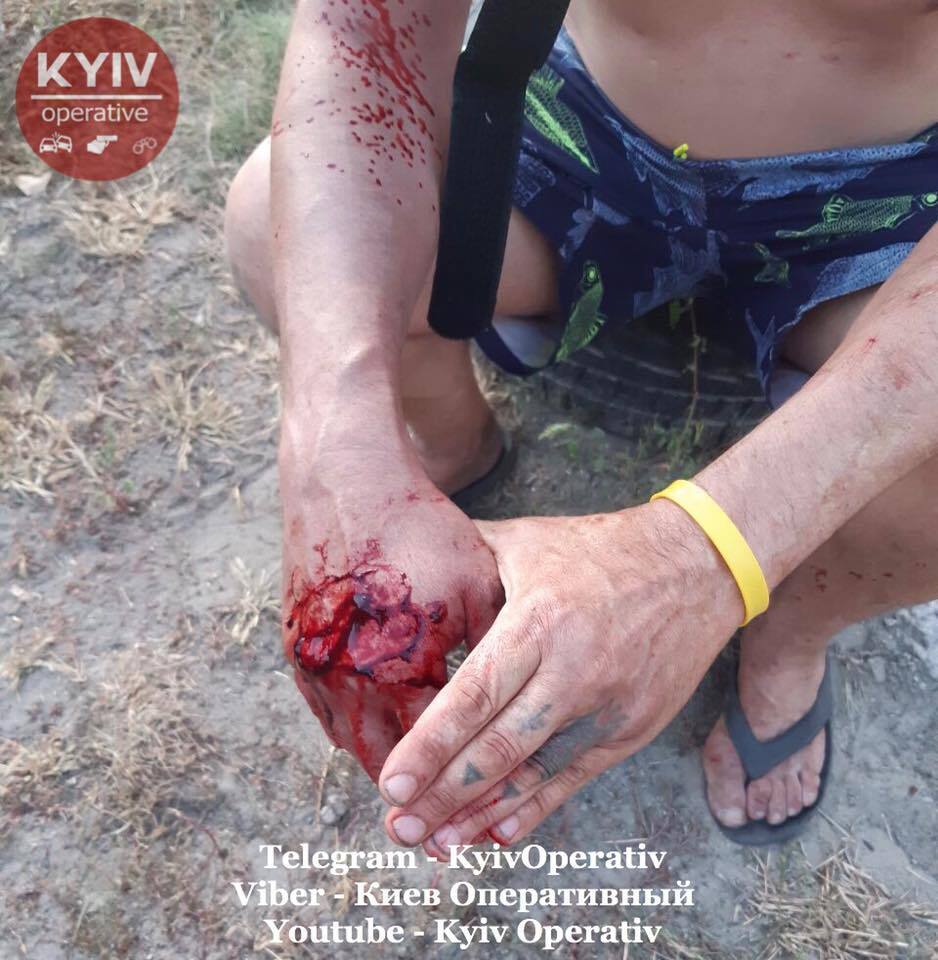 В Киеве устроили кровавые разборки на ножах: фото 18+