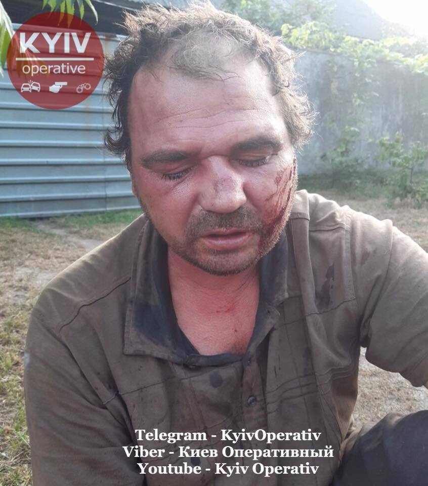 В Киеве устроили кровавые разборки на ножах: фото 18+