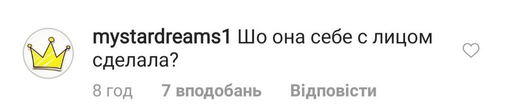 "Обличчя не людське": Лорак розбурхала мережу змінами в зовнішності