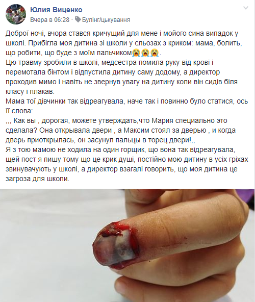 У школі на Київщині дитина ледь не позбулася пальця. Фото 18+
