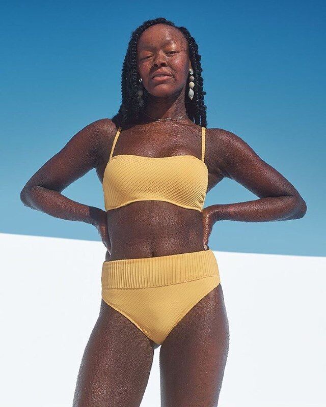 Чешуя вместо кожи: модель с редким заболеванием снялась в рекламе купальников