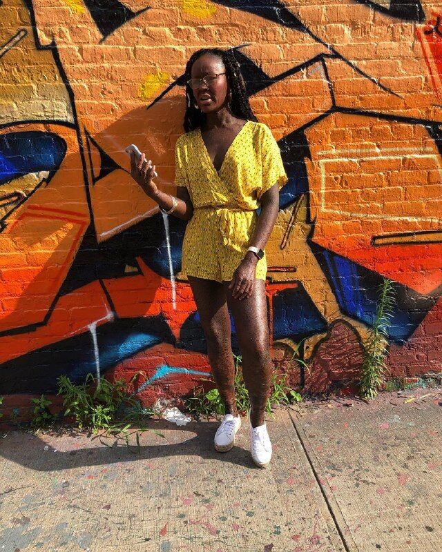 Чешуя вместо кожи: модель с редким заболеванием снялась в рекламе купальников