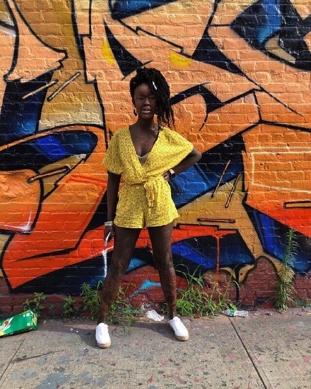 Чешуя вместо кожи: модель с редким заболеванием снялась в рекламе купальников