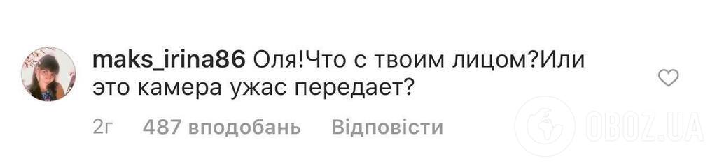 "Що з обличчям? Жах": Бузову розгромили за зовнішній вигляд