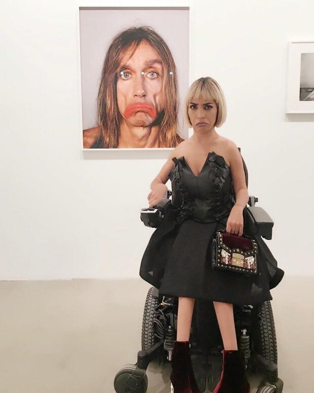 Необычная красота: пять самых известных моделей с редкими заболеваниями