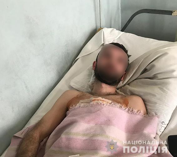 В Киеве террорист "ДНР" ранил 25-летнего участкового офицера