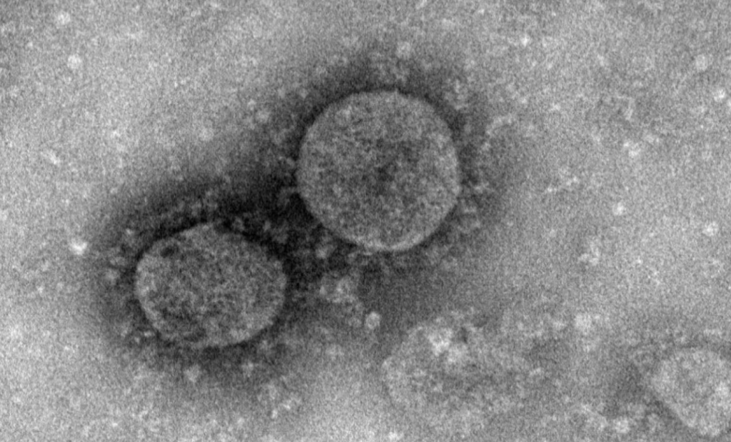 Исследователи разработали вакцину против коронавируса