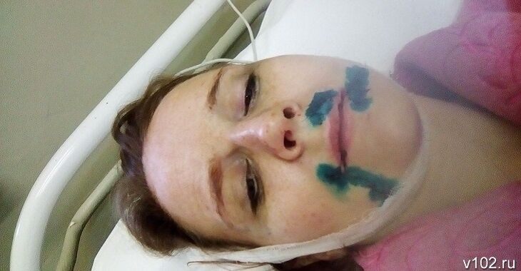 В Волгограде (Россия) пассажир напал на 35-летнюю женщину-водителя "Яндекс.Такси", изрезав ножом ее лицо