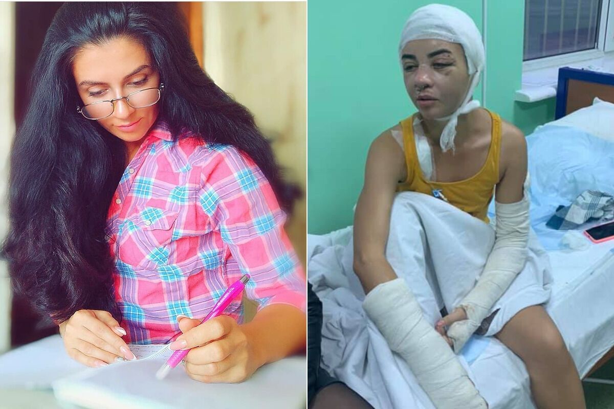 Ольга до и после жестокого избиения
