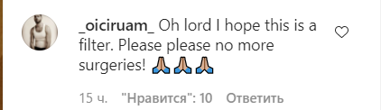 62-річна Мадонна збентежила фанатів неприродною формою обличчя на фото