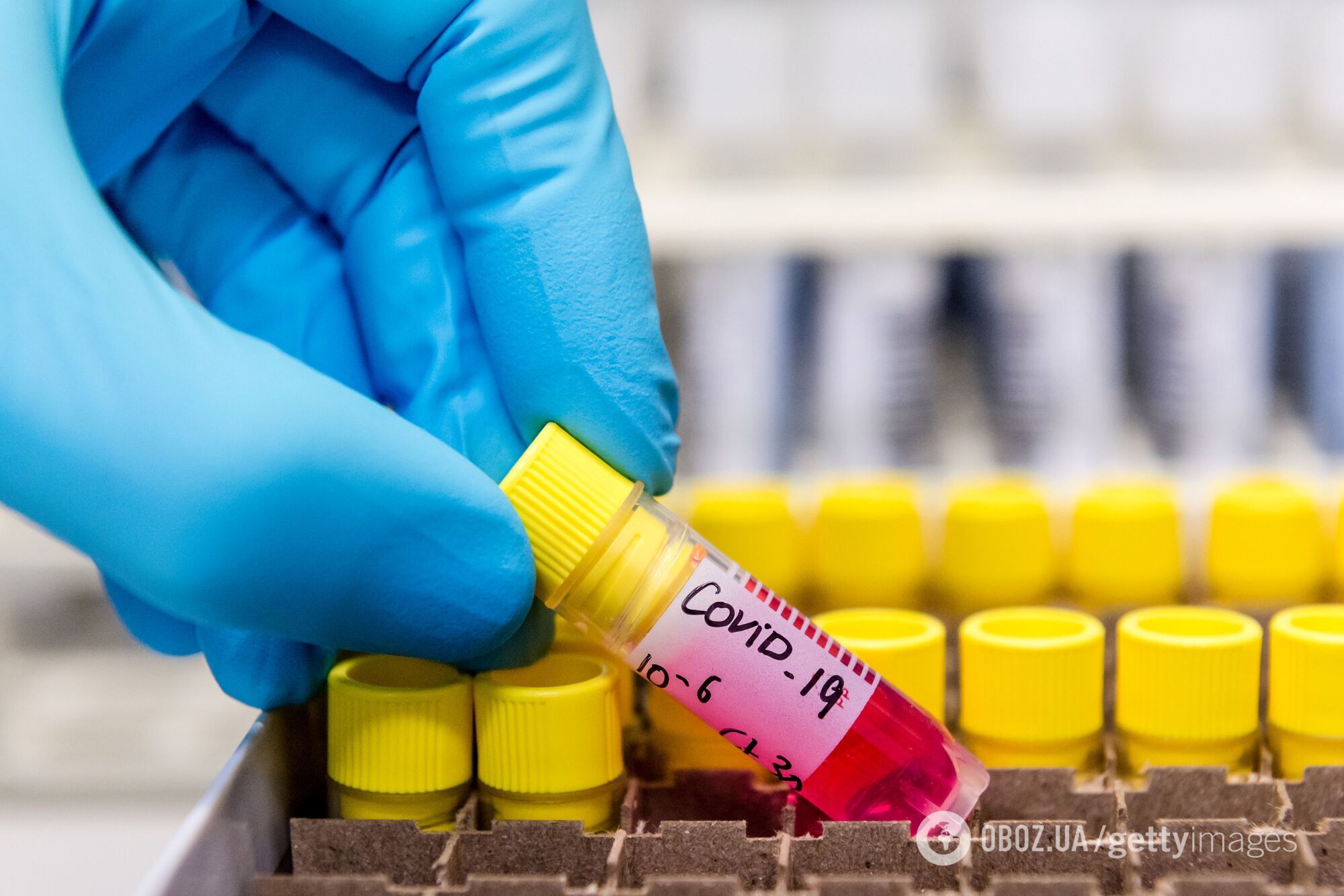 "Россия не публикует промежуточные результаты исследований своей вакцины, и это вызывает беспокойство"