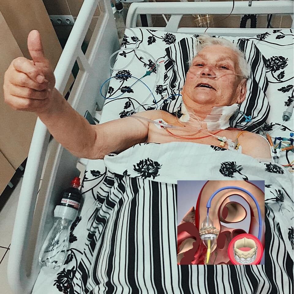 80-летней жительнице Львовщины сердечный клапан пересадили без единого разреза.