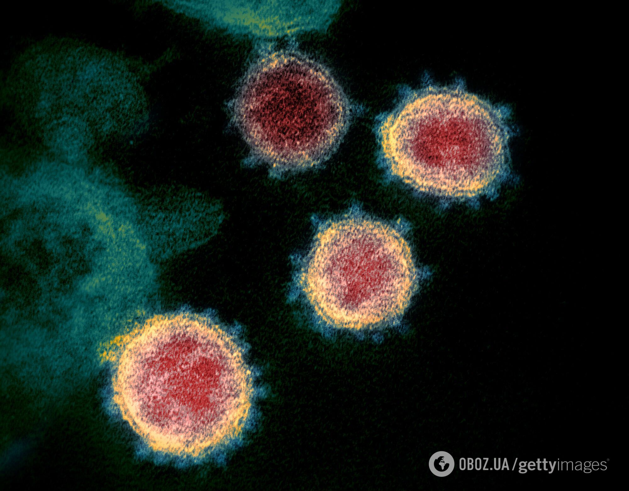 "Теоретично коронавірус може зникнути сам по собі".