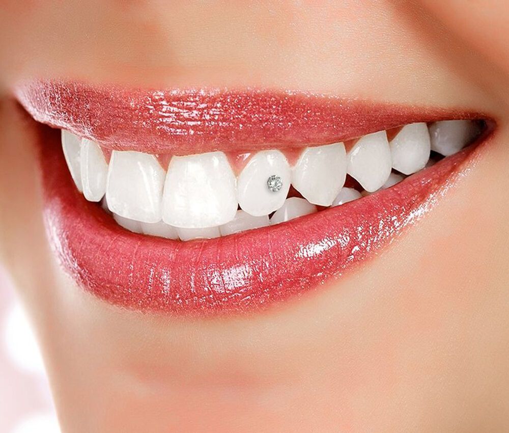 Скайсы – это специальные стразы для стоматологии