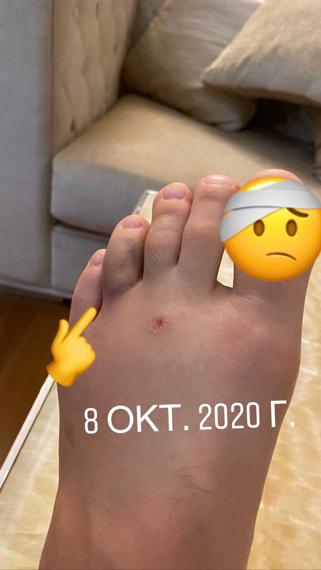 Хабіб показав ліву ногу після перелому пальця