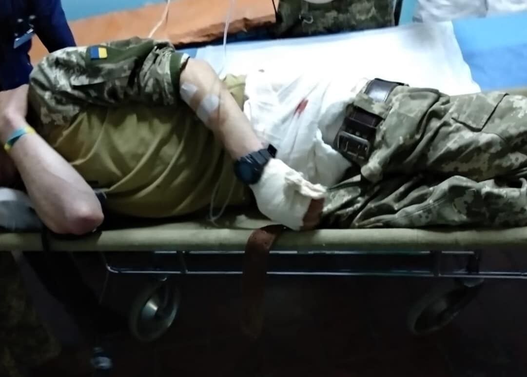 Російські окупанти поранили на Донбасі воїна ЗСУ