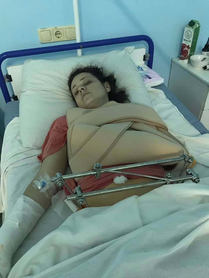 Юлия Павленко (Глущенко), которую сбил водитель Uber, понесла тяжелые переломы таза и рук.