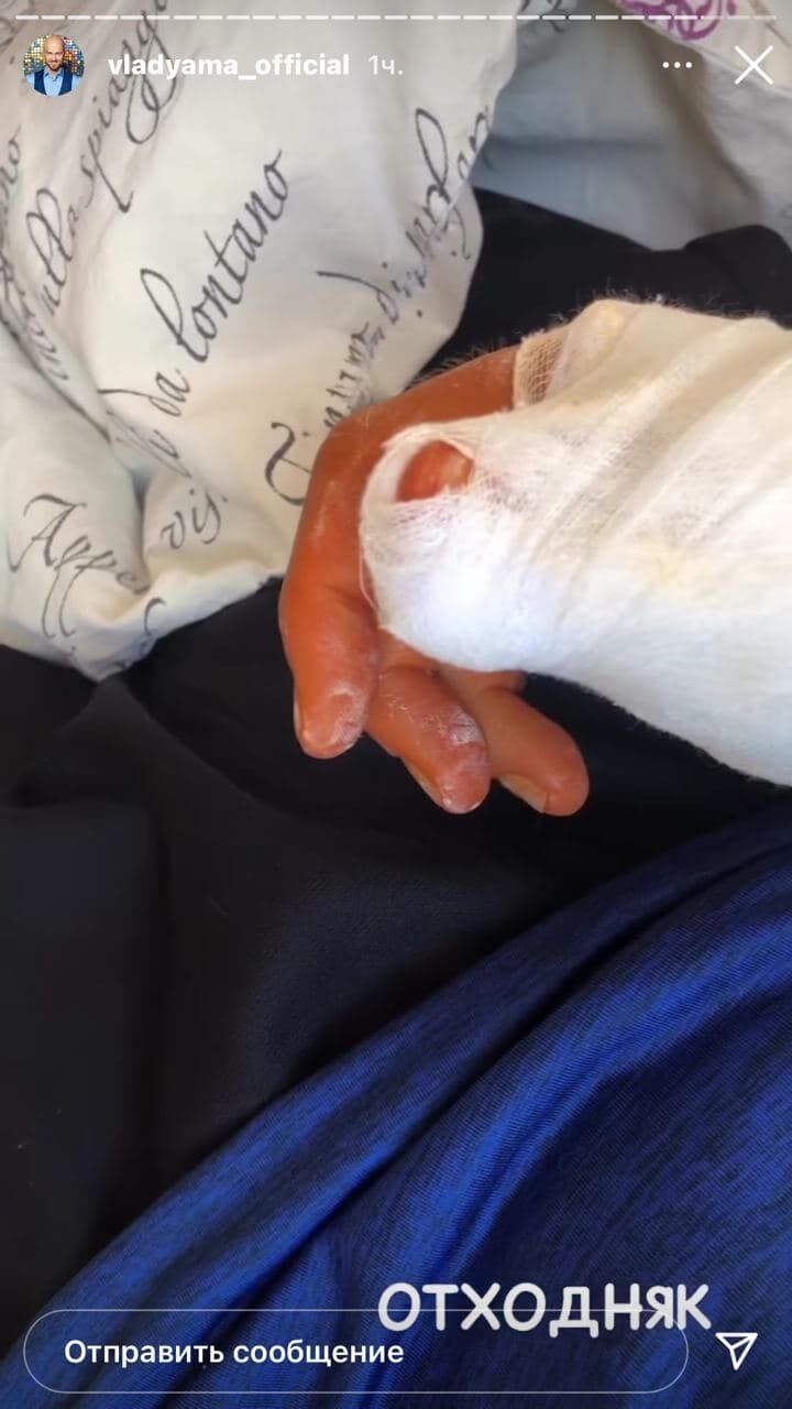 Влад Яма переніс операцію на руці