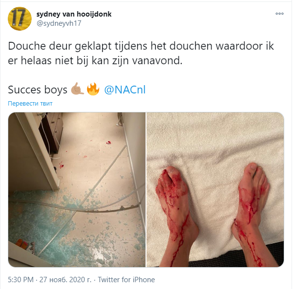 Нідерландський футболіст застряг у душі й отримав криваву травму. Фото 18+