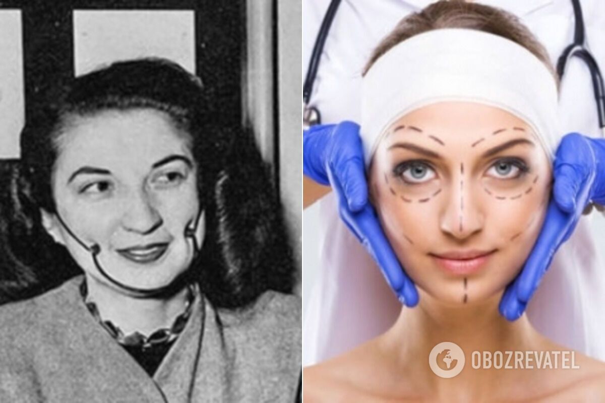 Пластическая хирургия в 1930 году и сейчас
