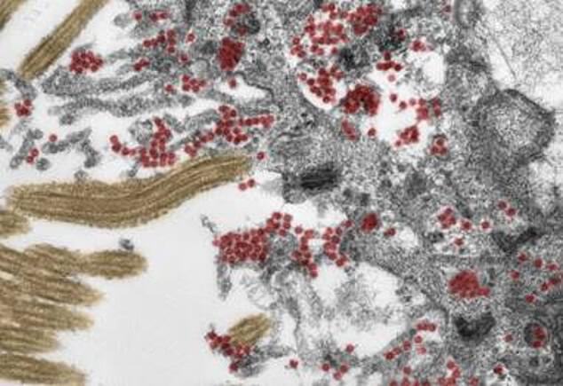 Изображение неповрежденных частиц коронавируса в слизи.