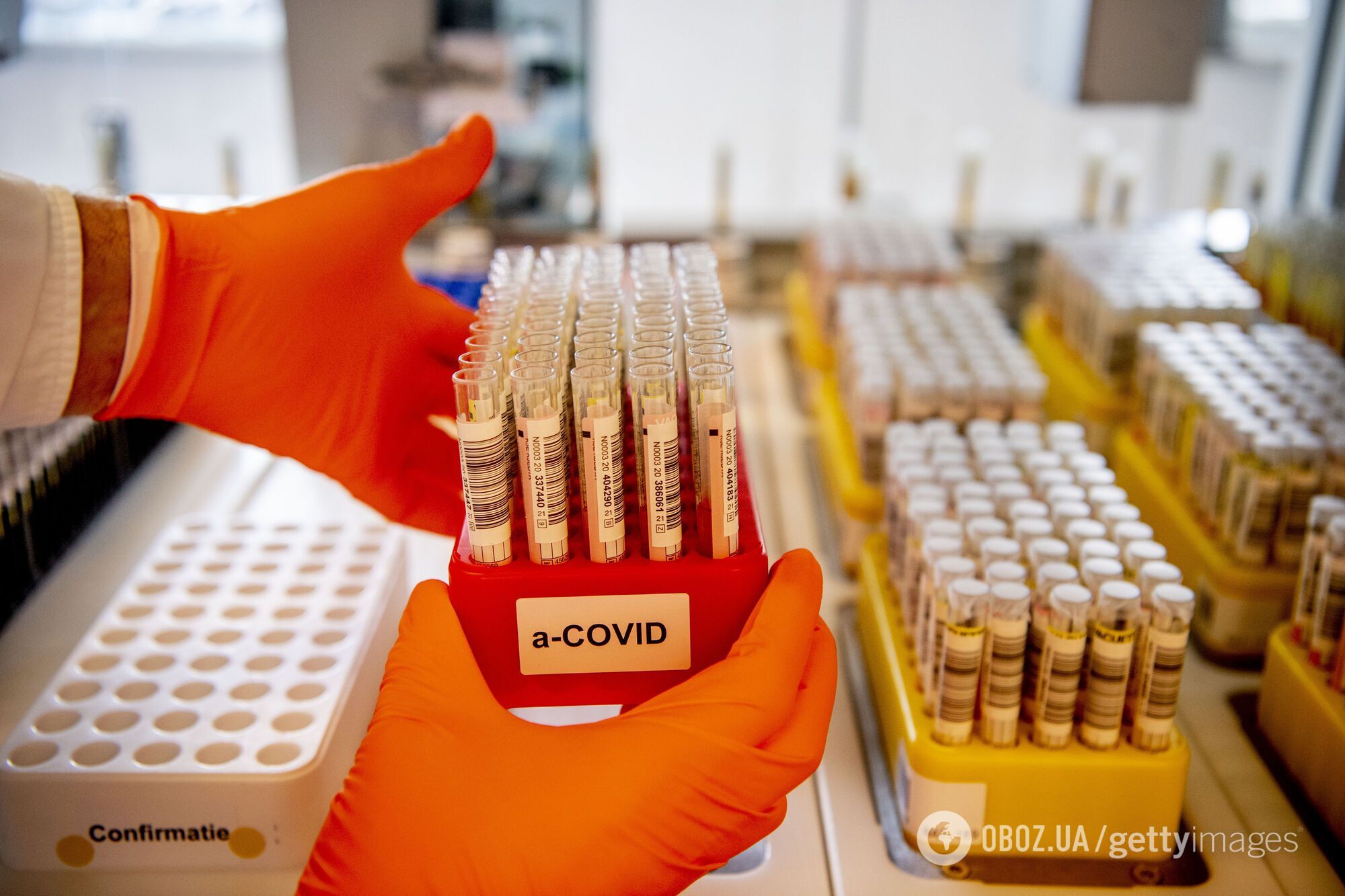 В Украине нет оборудования для транспортировки и хранения вакцины от коронавируса.